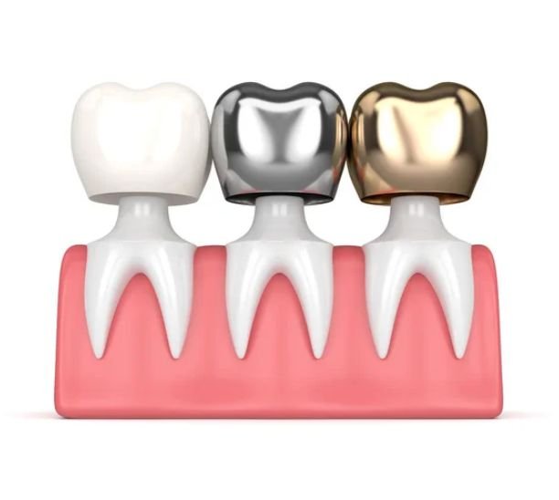 Dental Crown
